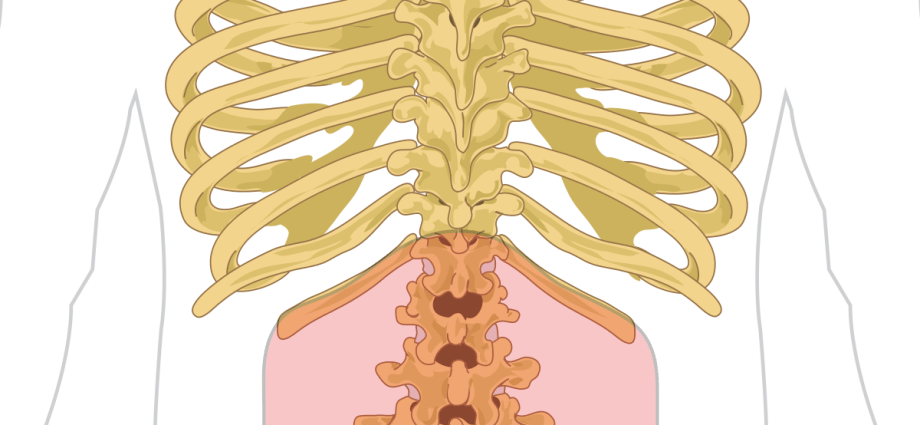 Pain in lumbalgia &#8211; characteristics and management