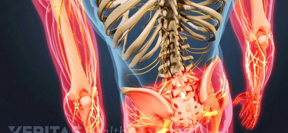 Pains in discopathy