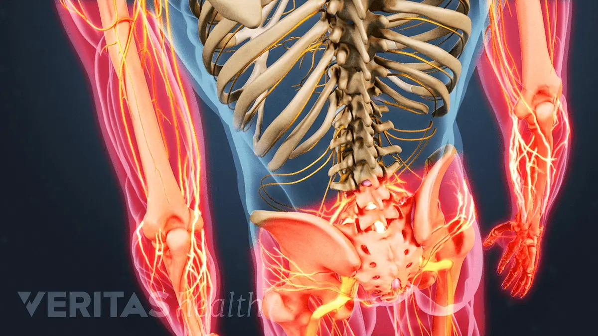 Pains in discopathy