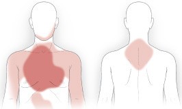 Pains located outside the heart area