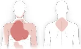 Pains located outside the heart area