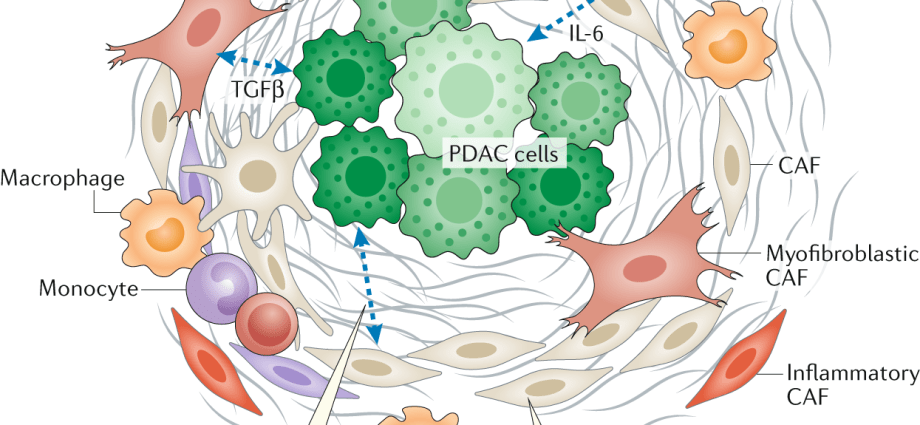 Pancreatic cancer is a challenge for oncology