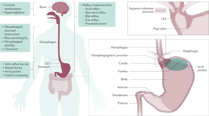 Panprazox &#8211; what it works for, indications, contraindications, side effects. Treatment of gastro-oesophageal reflux disease