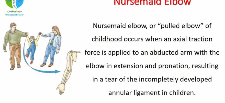 Parents are usually responsible for this common trauma in children. What is a nurse&#8217;s elbow?