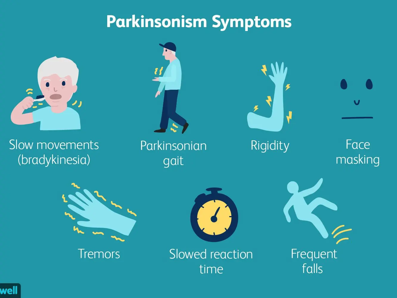 Parkinson&#8217;s attacks men more often. The neurologist explains what the first symptoms are and when they appear