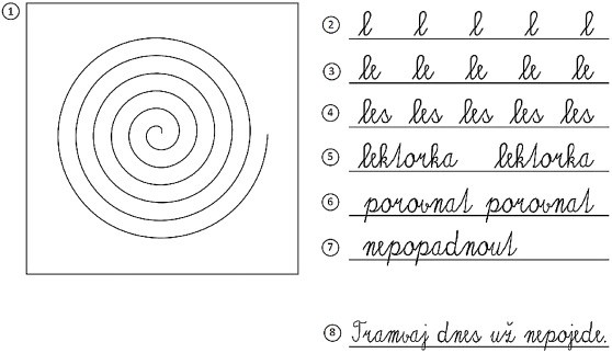 Parkinson&#8217;s diagnosis based on handwriting evaluation