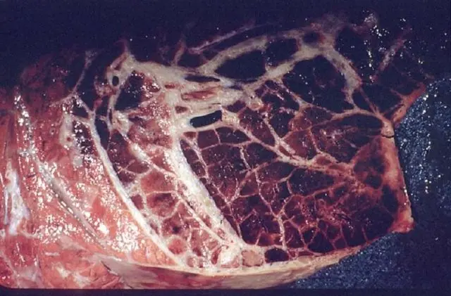 Pasteurellosis in cattle: vaccine against the disease, treatment and prevention