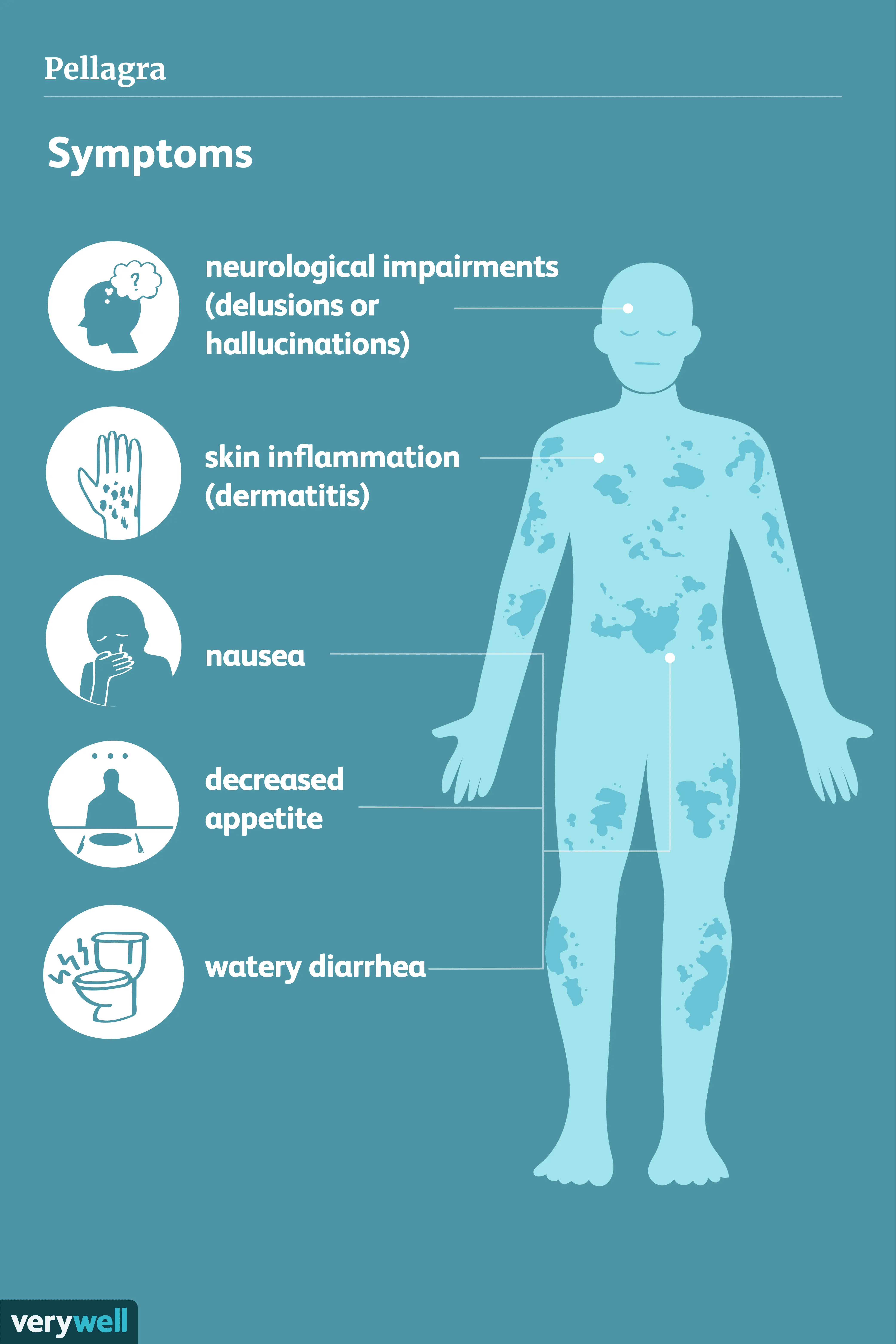 Pellagra &#8211; skin symptoms, diagnosis, treatment