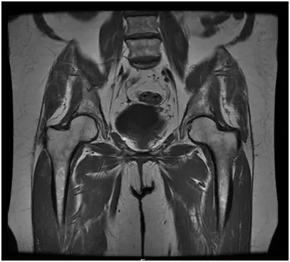 Pelvic MRI &#8211; when to perform? What can be detected during pelvic resonance imaging?