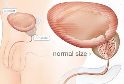 Penis diseases &#8211; priapism, phimosis, inflammation of the glans