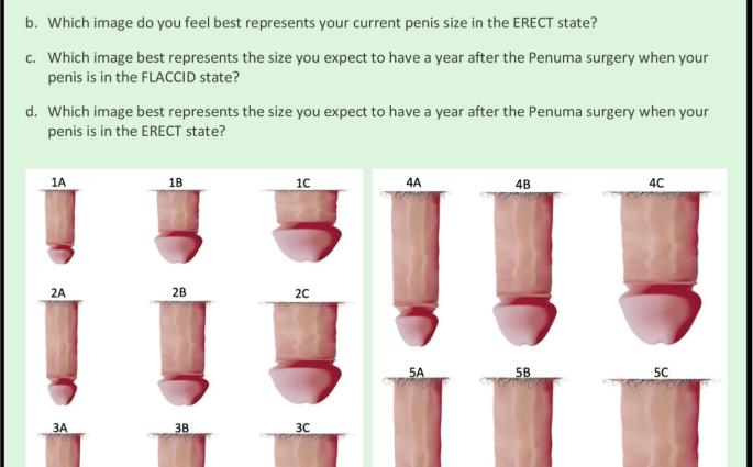 Penis enlargement &#8211; methods and indications. Which way to choose?