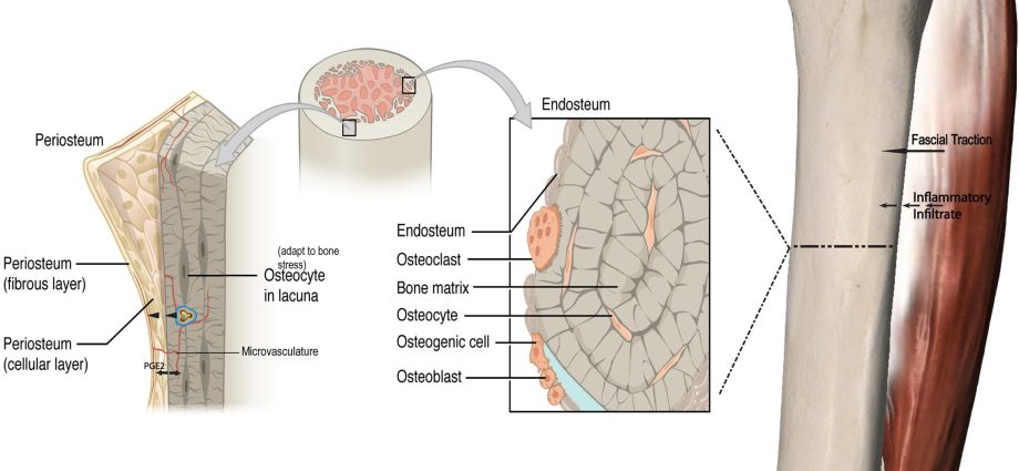 Periosteum &#8211; causes of inflammation, symptoms, treatment