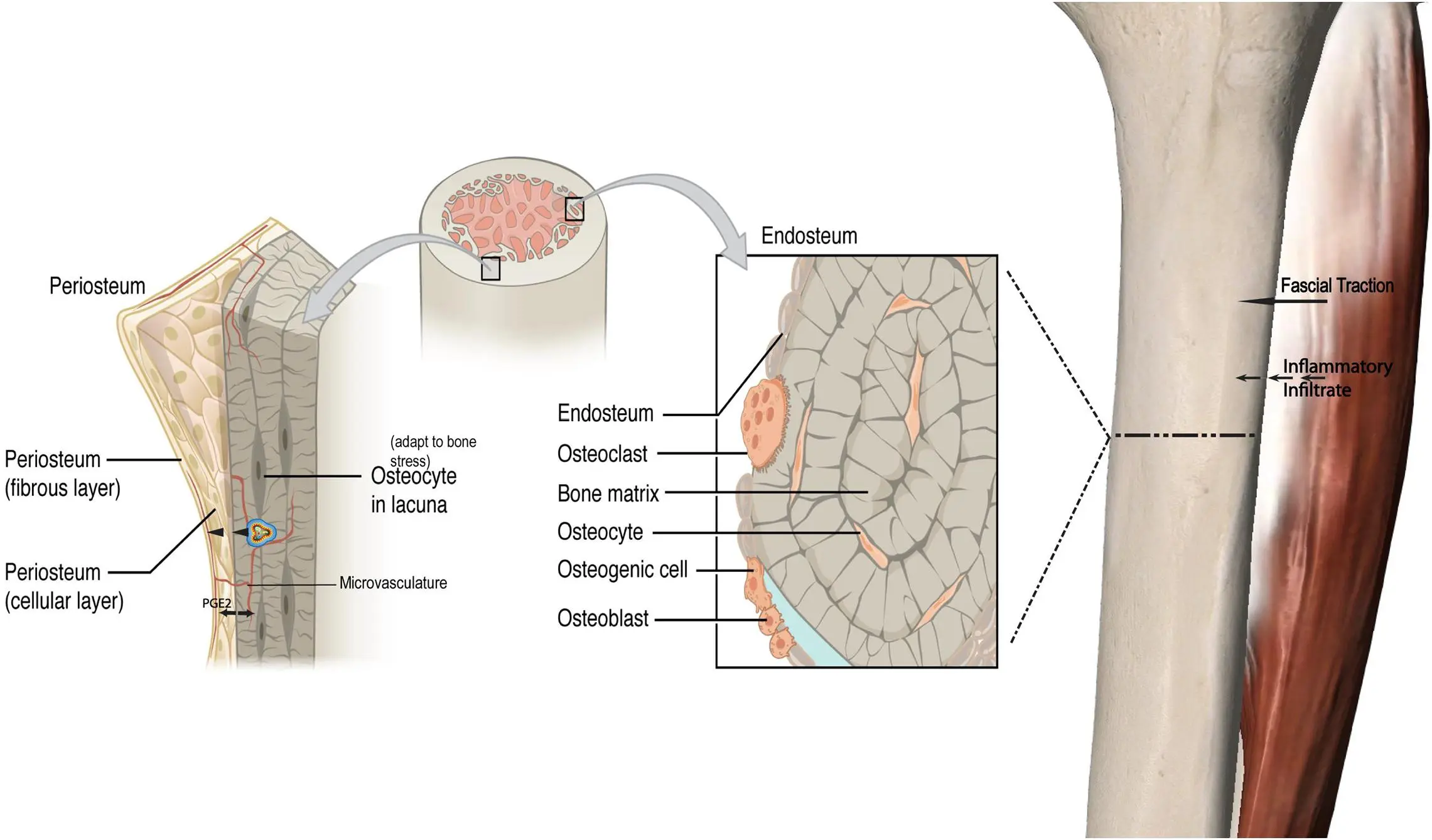 Periosteum &#8211; causes of inflammation, symptoms, treatment