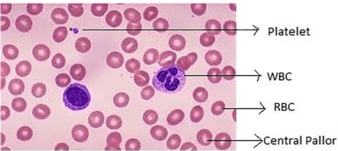 Peripheral blood counts &#8211; blood test results. Morphology with manual and automatic smear