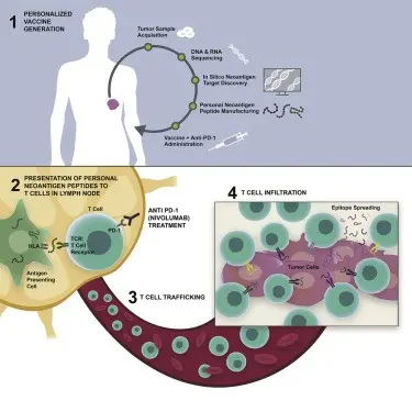 Personalized therapy extends the life of lung cancer patients