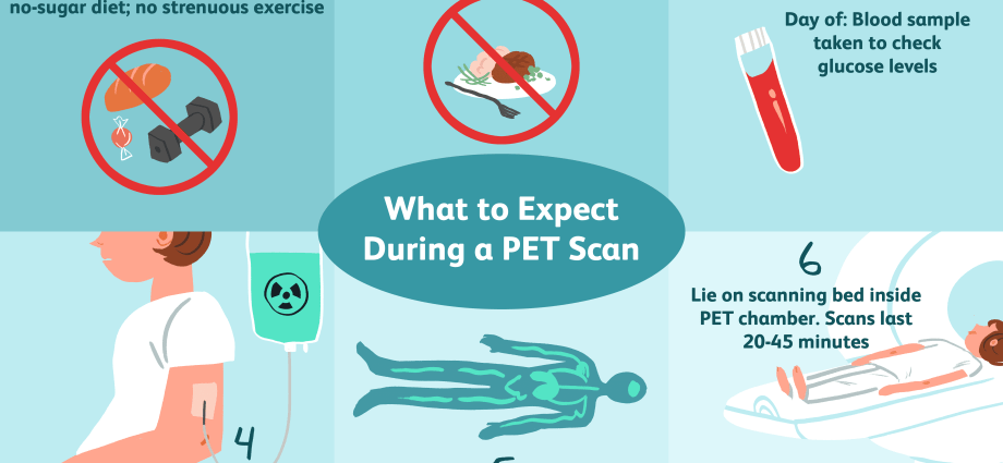 PET examination &#8211; indications and preparation. What does a PET scan look like?