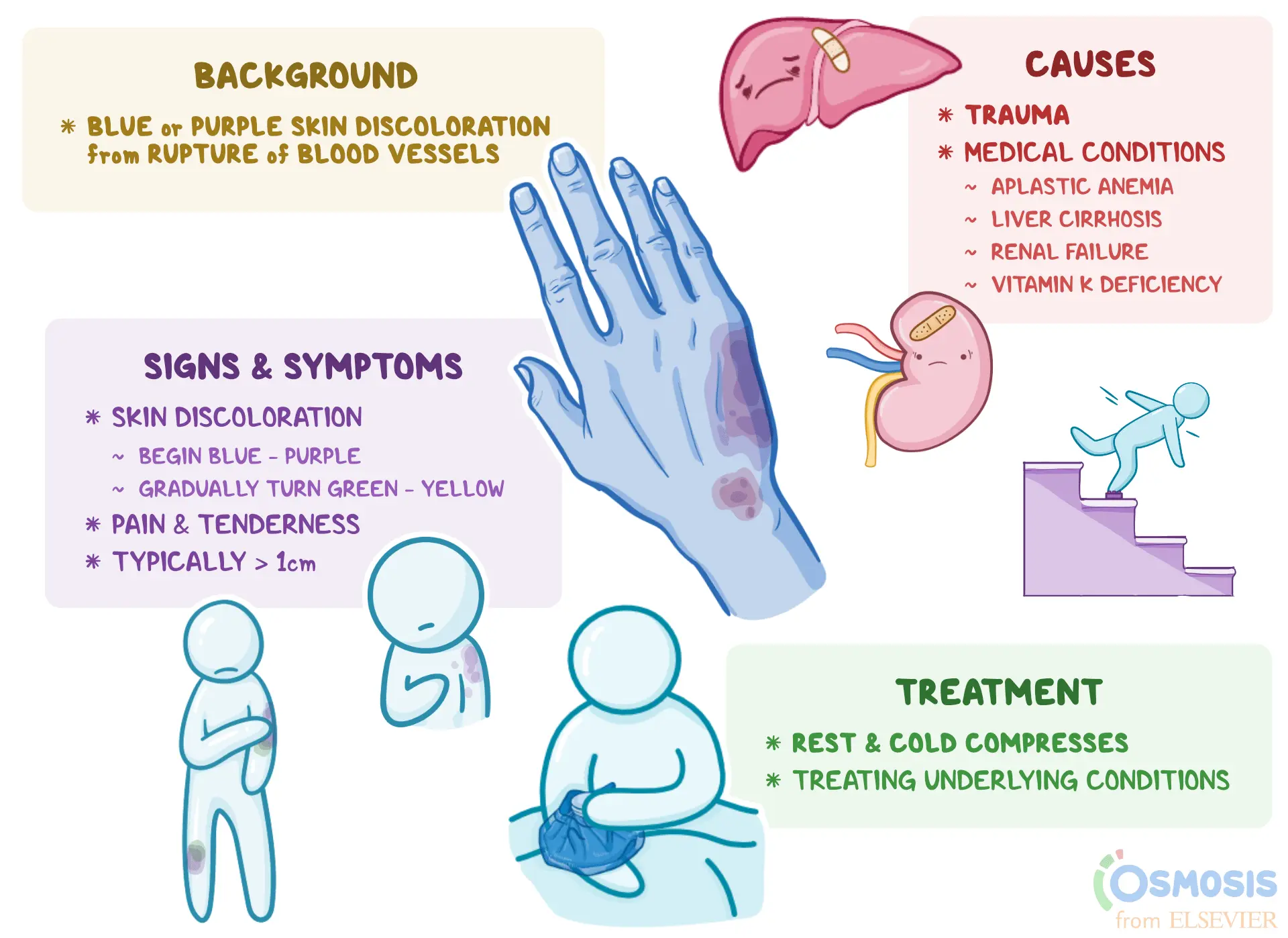 Petechiae &#8211; why do they appear on the body? Diagnosis and treatment of ecchymosis