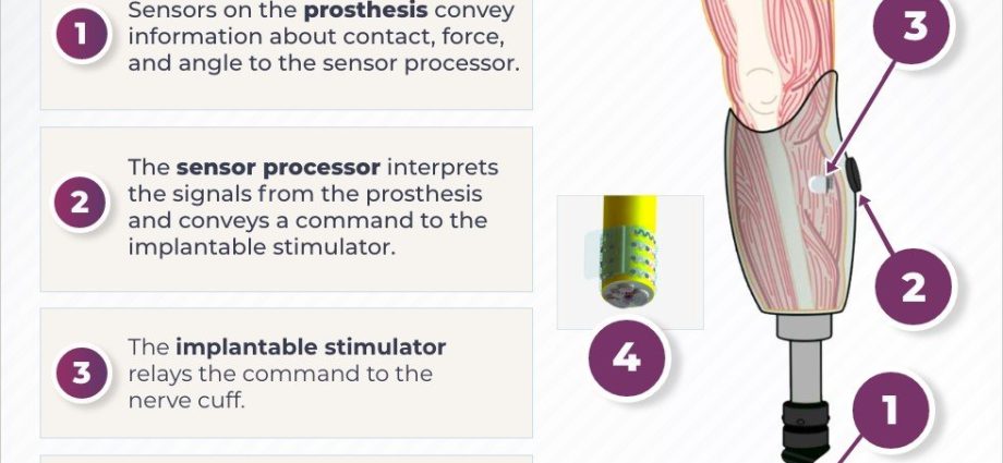 Phantom pain &#8211; what is it, causes, how to combat it?