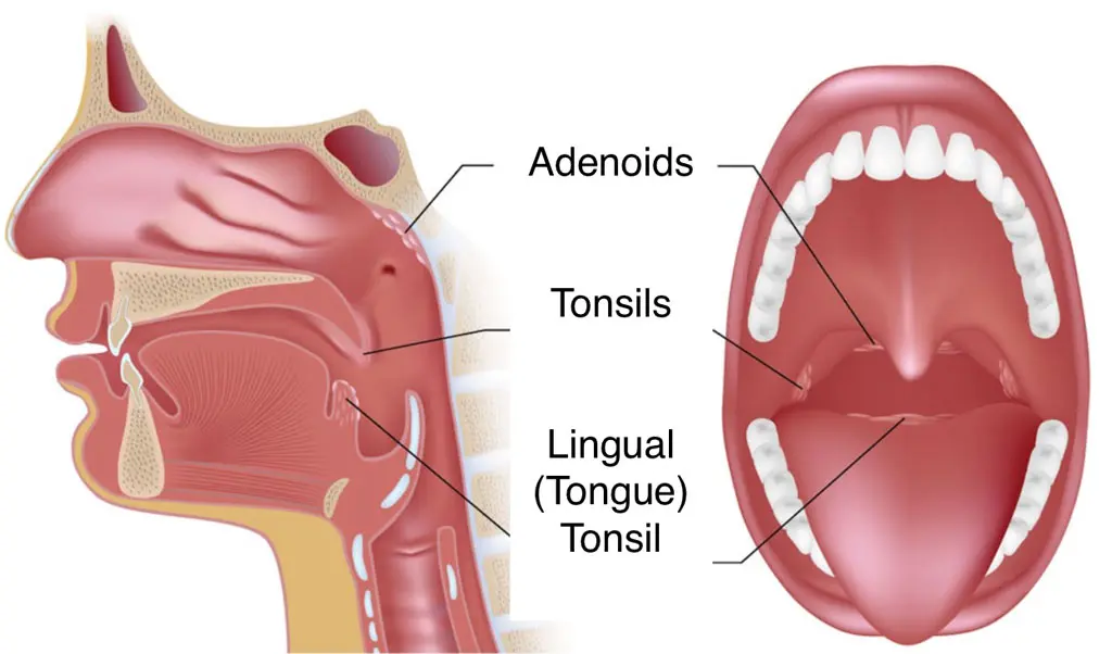 Pharyngeal tonsil &#8211; what are the symptoms of hypertrophy and what is the surgical treatment?