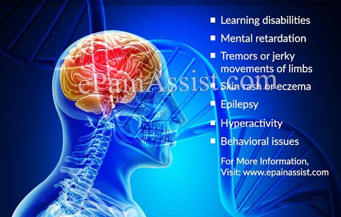 Phenylketonuria &#8211; causes, diagnosis, treatment. Diet in phenylketonuria