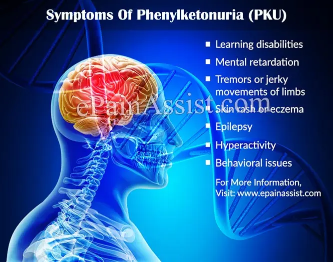 Phenylketonuria &#8211; causes, diagnosis, treatment. Diet in phenylketonuria