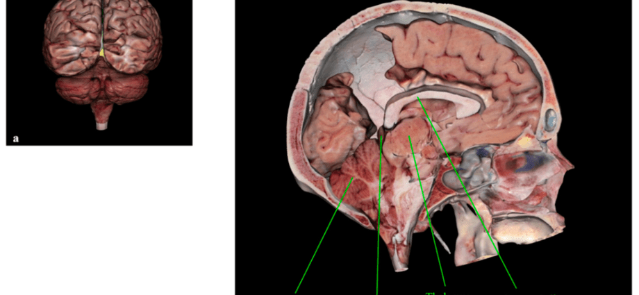 Pineal gland &#8211; location, pineal tumor, prophylaxis [EXPLAINED]