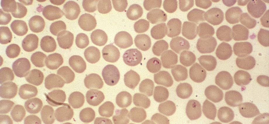 Piroplasmosis CRS