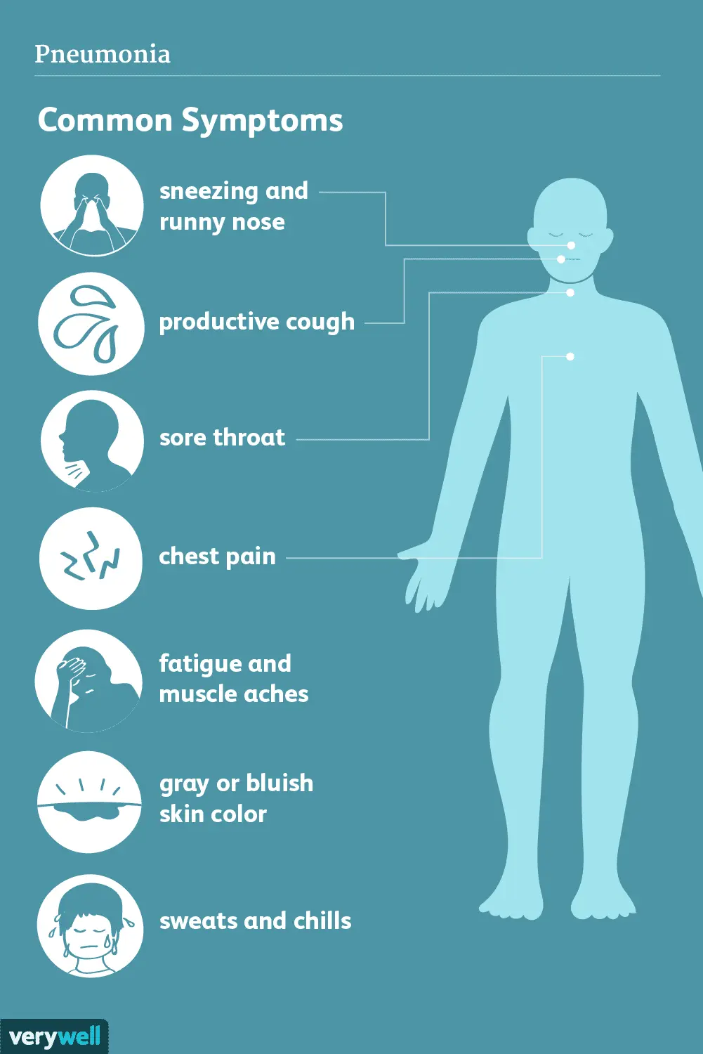 Pneumonia &#8211; symptoms, complications, treatment