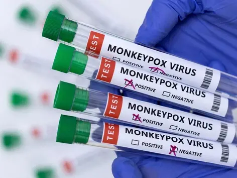 Poland wants to buy drugs for monkey pox. Talks with the producer are ongoing