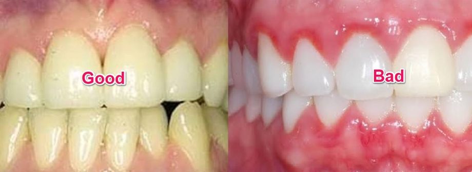 Polish dentists will recommend teeth treatment in Africa