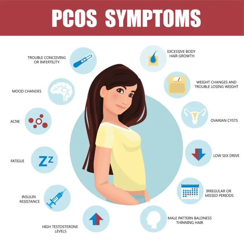 Polycystic Ovary Syndrome &#8211; Symptoms and Treatment of PCOS