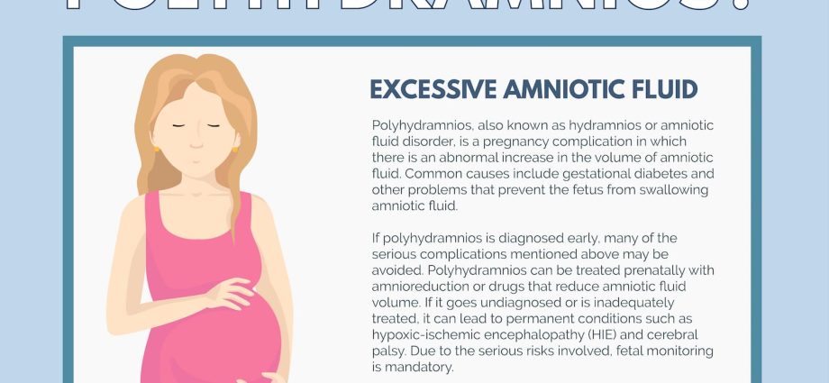 Polyhydramnios in pregnancy &#8211; causes, symptoms and treatment