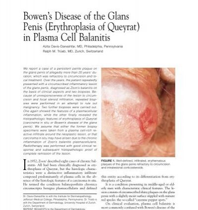 Pre-neoplastic conditions of the mucosa &#8211; white keratosis, Bowen&#8217;s disease, Queyrat erythroplasia