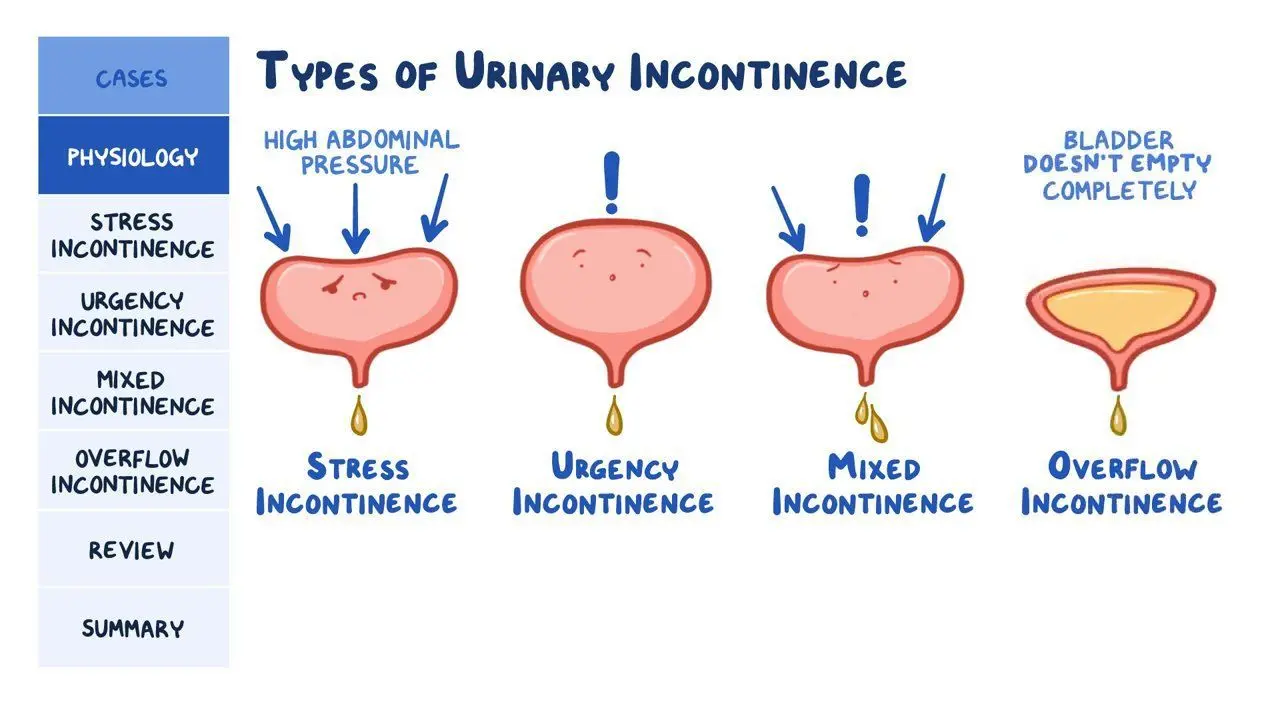 Pregnancy and NTM &#8211; when does urinary incontinence occur?