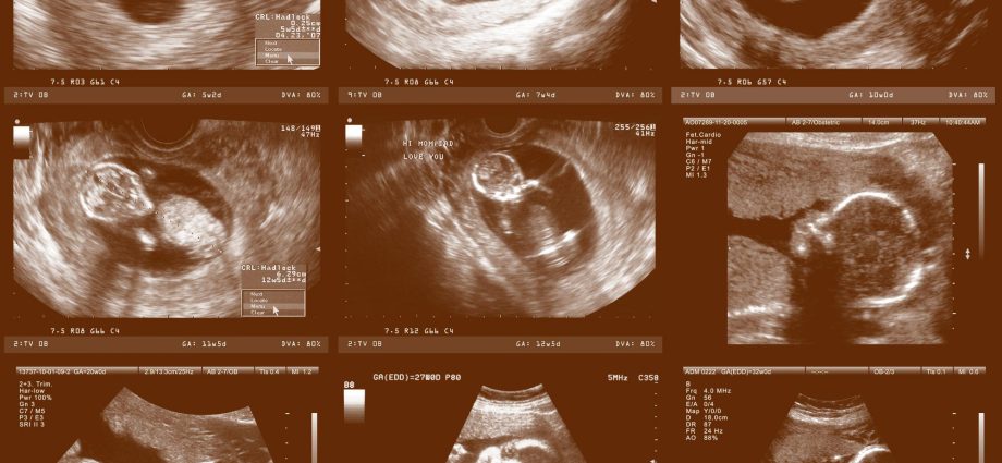 Pregnancy ultrasound &#8211; what is it about?