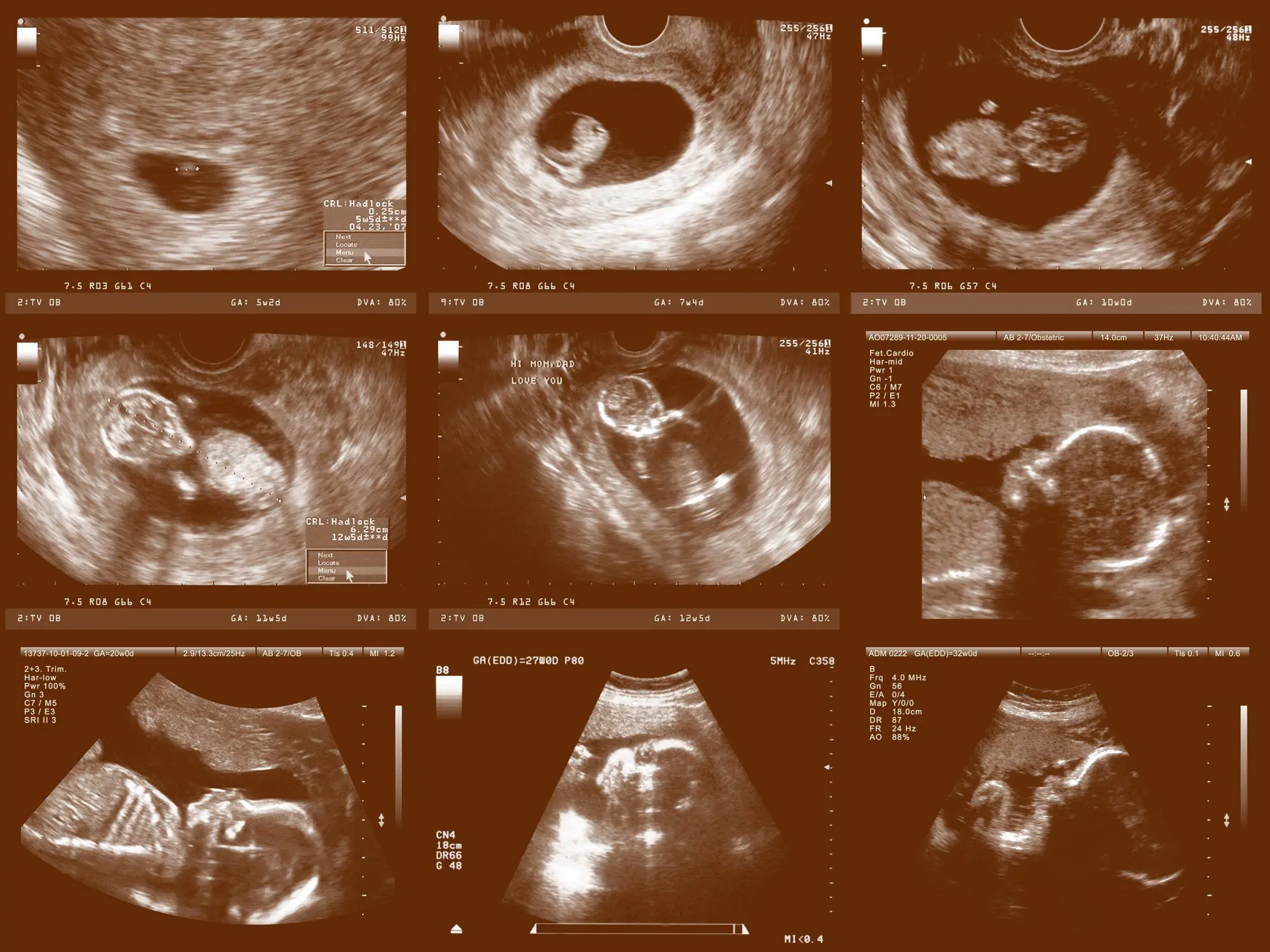 Pregnancy ultrasound &#8211; what is it about?