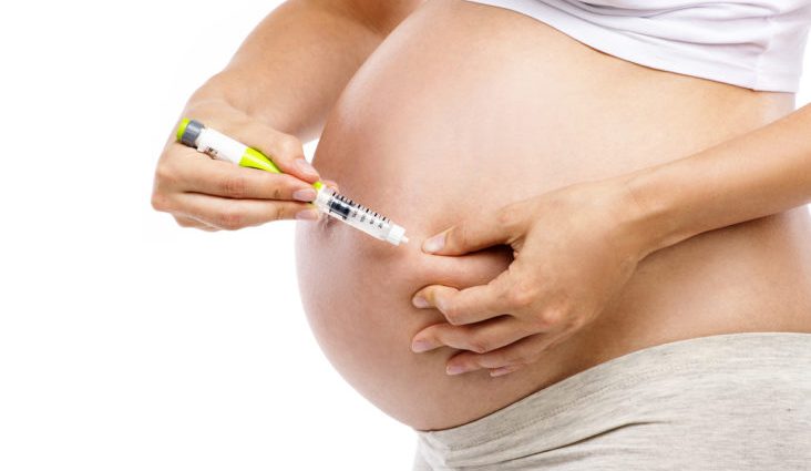 Pregnancy with diabetes &#8211; expert opinion, detection, insulin pump