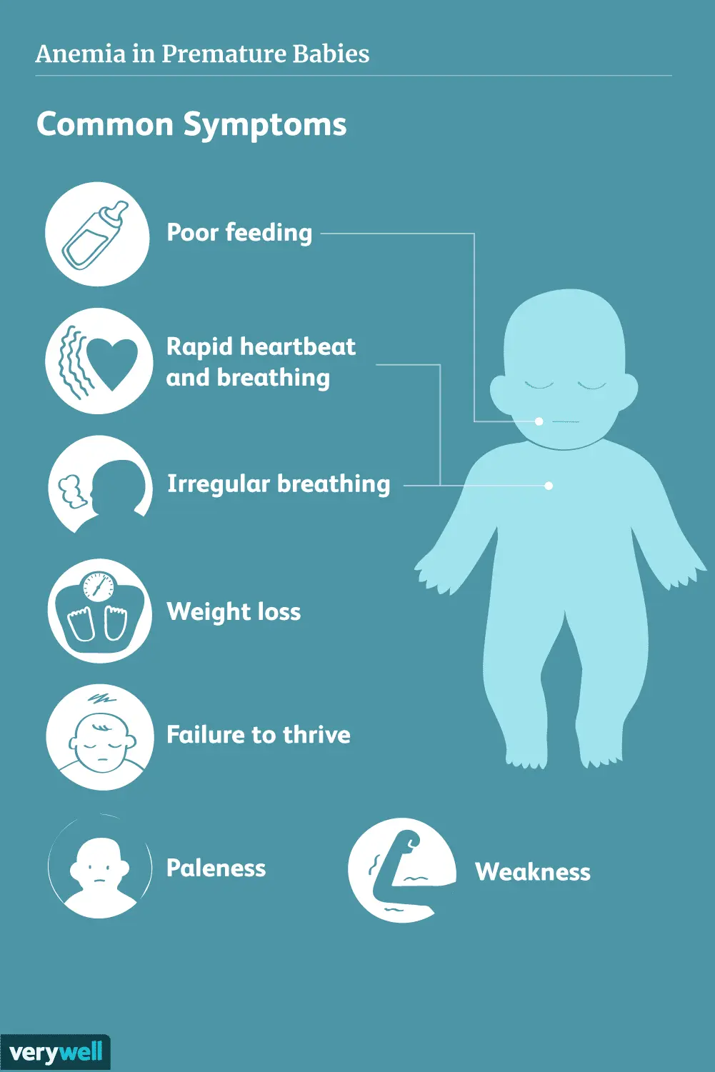 Premature baby &#8211; causes, symptoms, problems, care