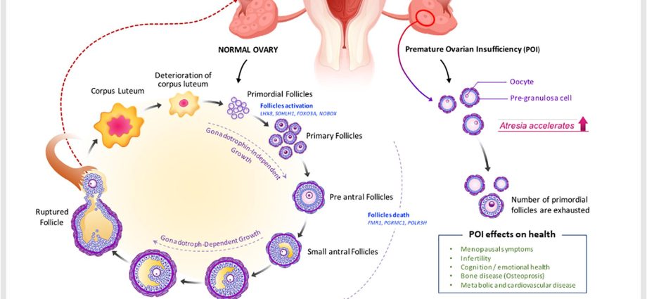 Premature ovarian failure (POF)