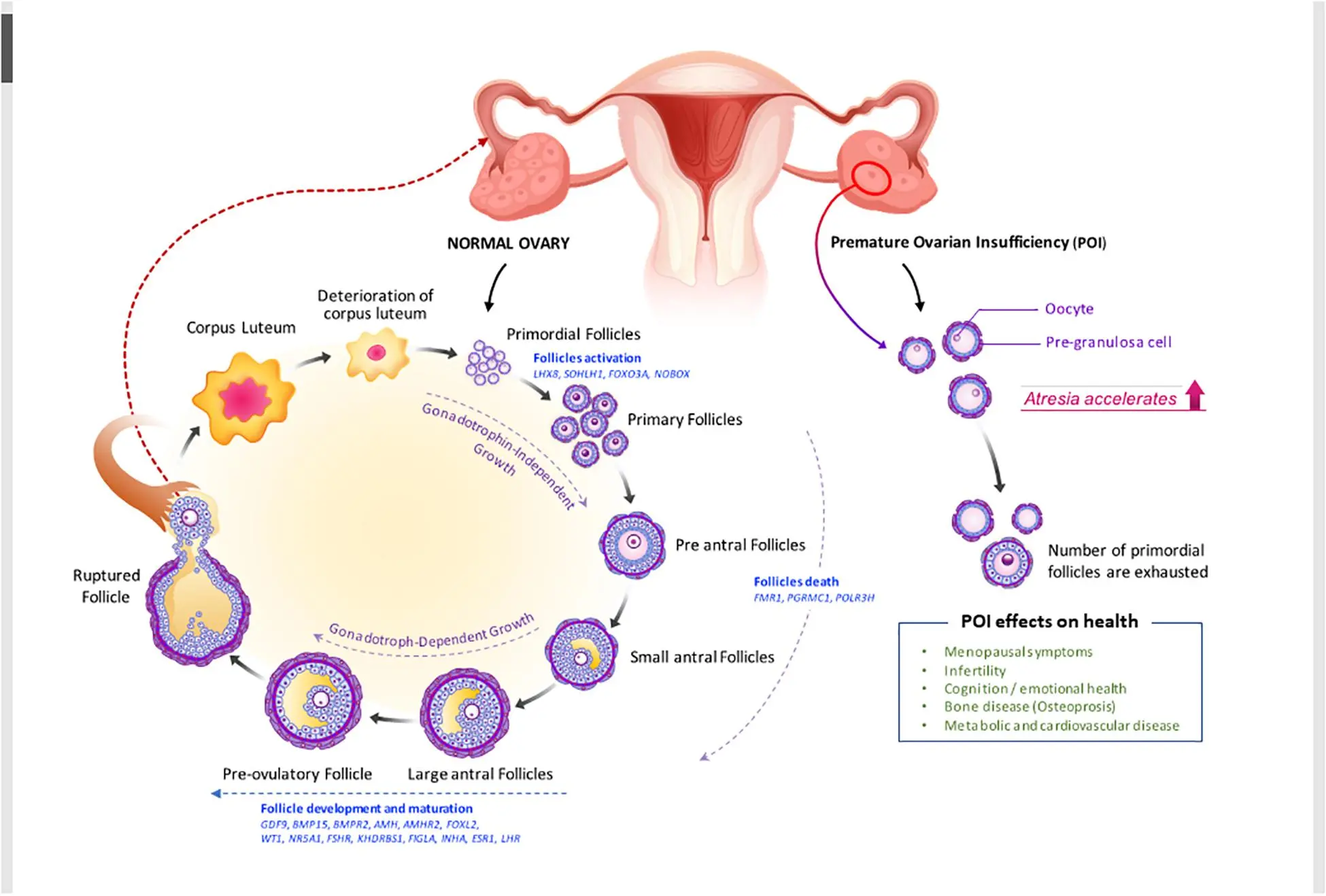 Premature ovarian failure (POF)