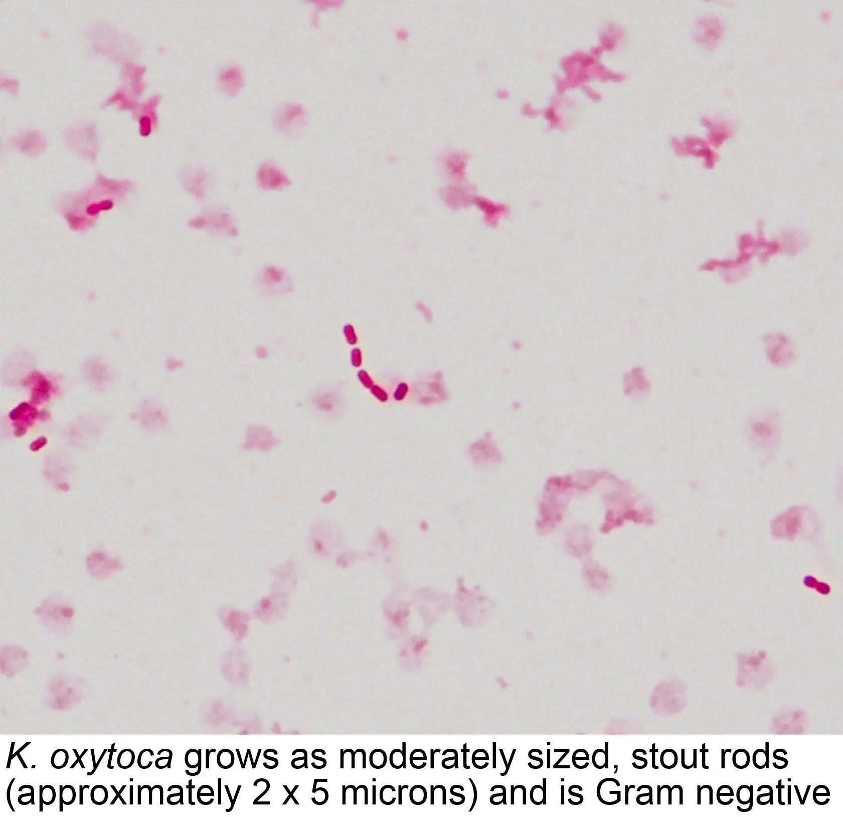 Presence of klebsiella oxytoca in the smear