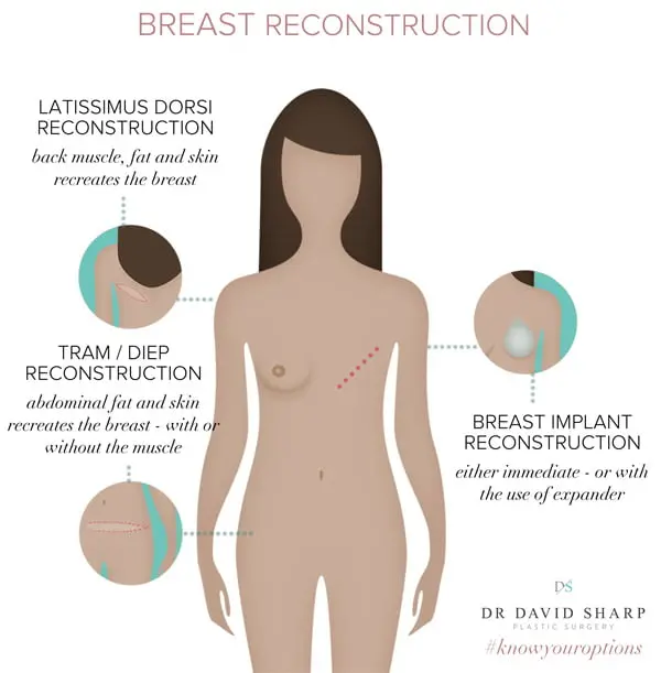 Preventive mastectomy &#8211; what is it and when is it performed?