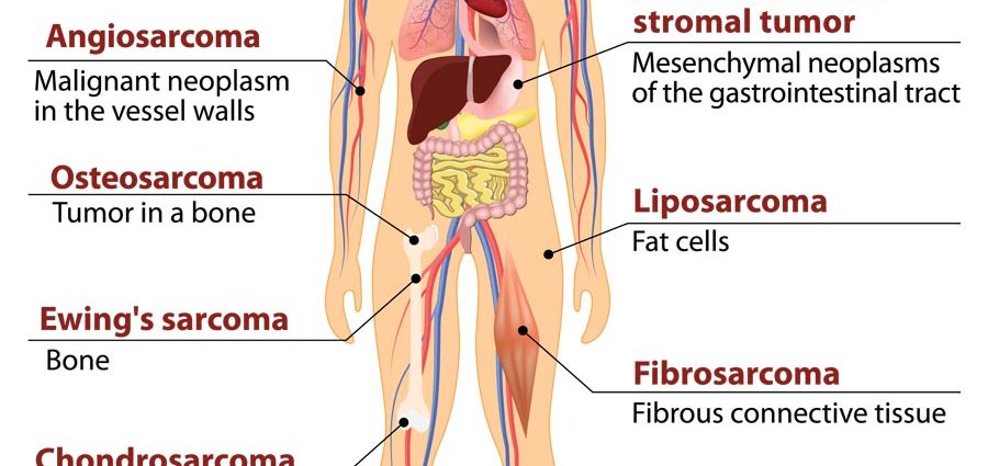 Primary neoplasms of the musculoskeletal system