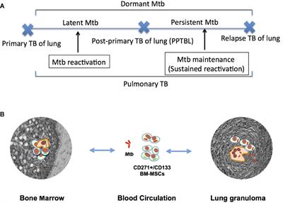 Primary tuberculosis