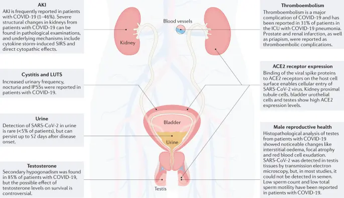 Problems urinating? It could be prostate cancer. Eight studies you need to do no matter what the pandemic is!