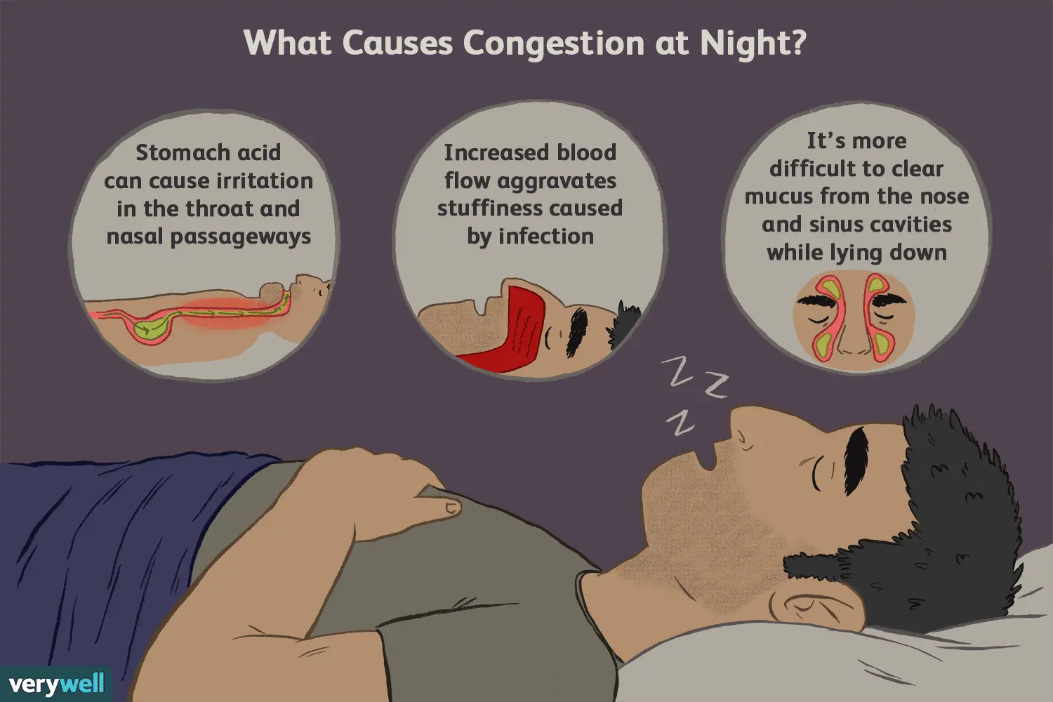 Problems with a stuffy nose. How to deal with a stuffy nose?