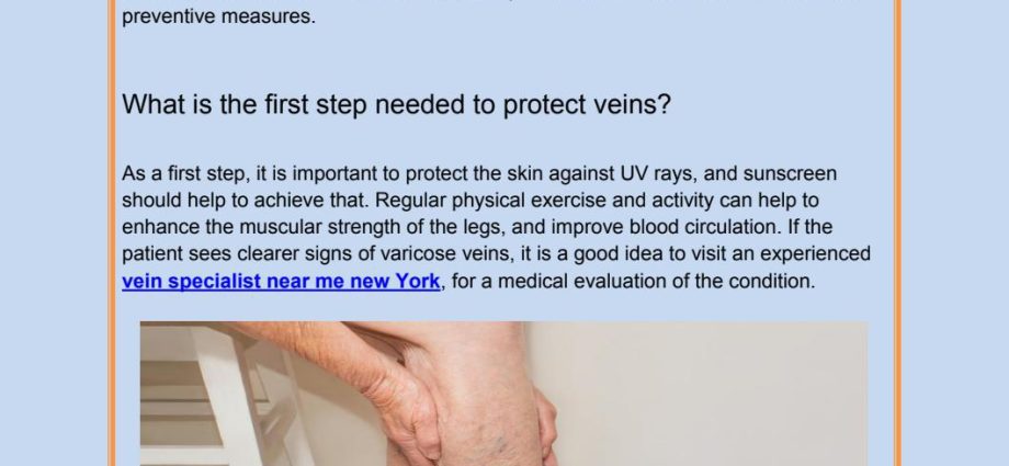 Problems with varicose veins &#8211; when to visit a phlebologist?