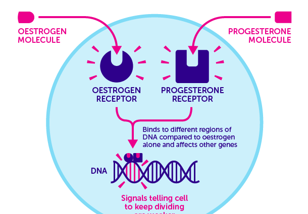 Progesterone can extend the life of one in two women with breast cancer