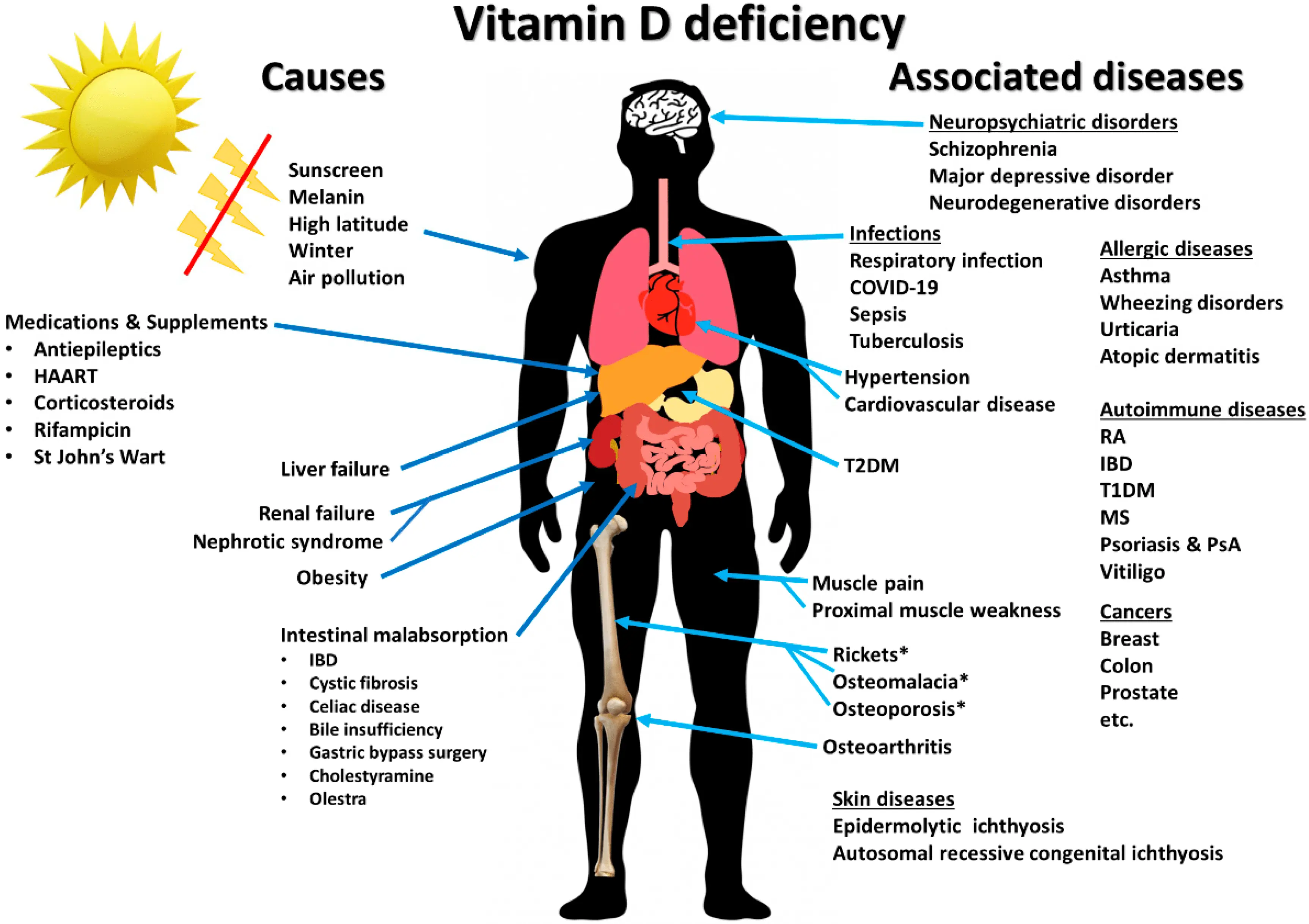 Properties of vitamin D &#8211; what health problems does it prevent?