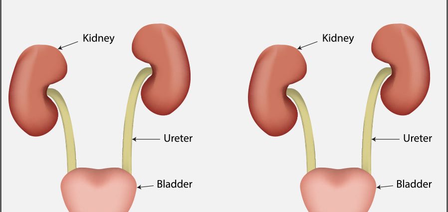 Prostate cancer &#8211; causes, symptoms, treatment and prognosis